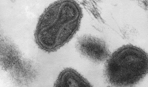 REGISTRA VIRUELA DEL MONO 131 CASOS EN PAÍSES NO ENDÉMICOS